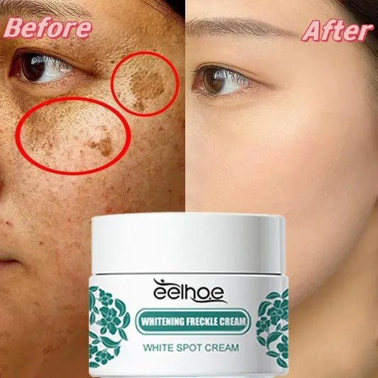 eelhoe Niacinamide Melasma Brightening Cream